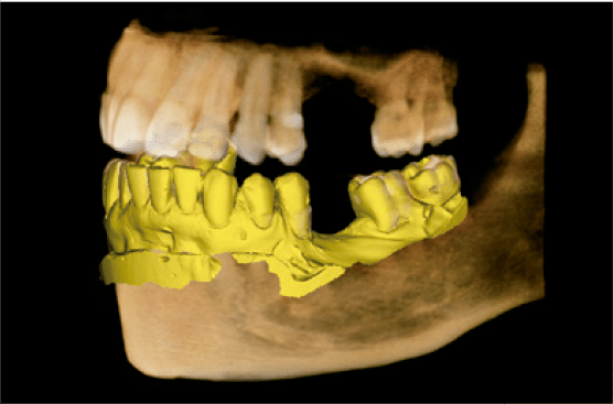 Escaneo de Modelos 3D