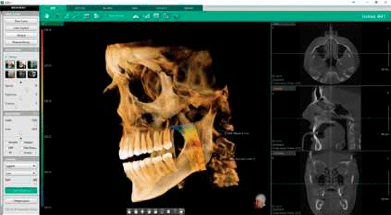 Demo vídeo Ez3D-i