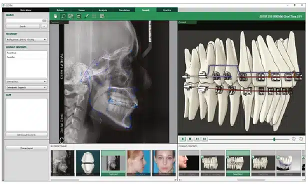 EzOrtho