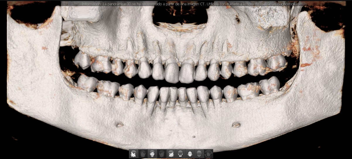 Panorámica 3D Smart Plus