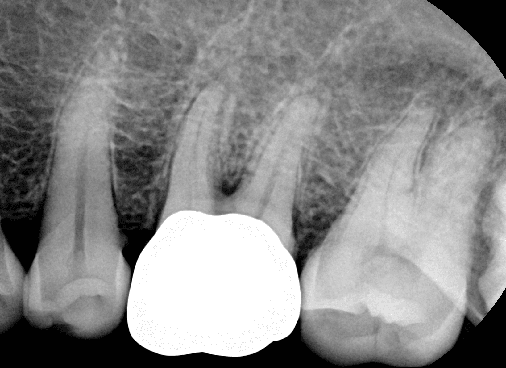 Portabilidad EzRay Air