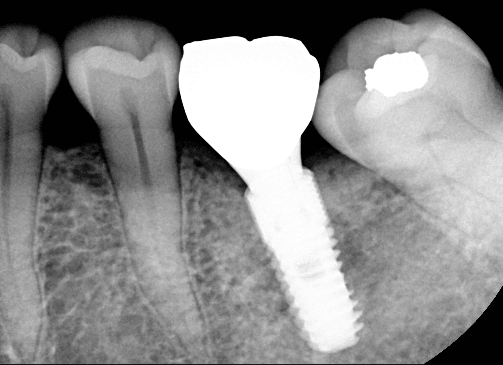 Kit de Legalización EzRay Air
